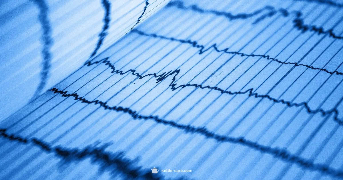 Corvo EKG Basics - Kettle Care
